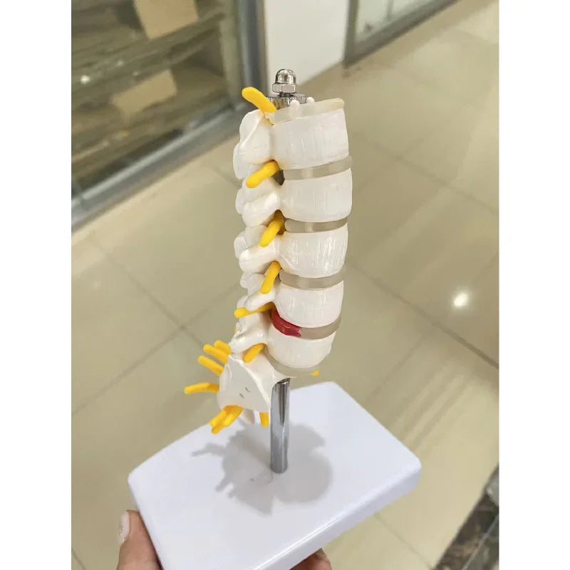 Lumbar Spine Anatomy Model