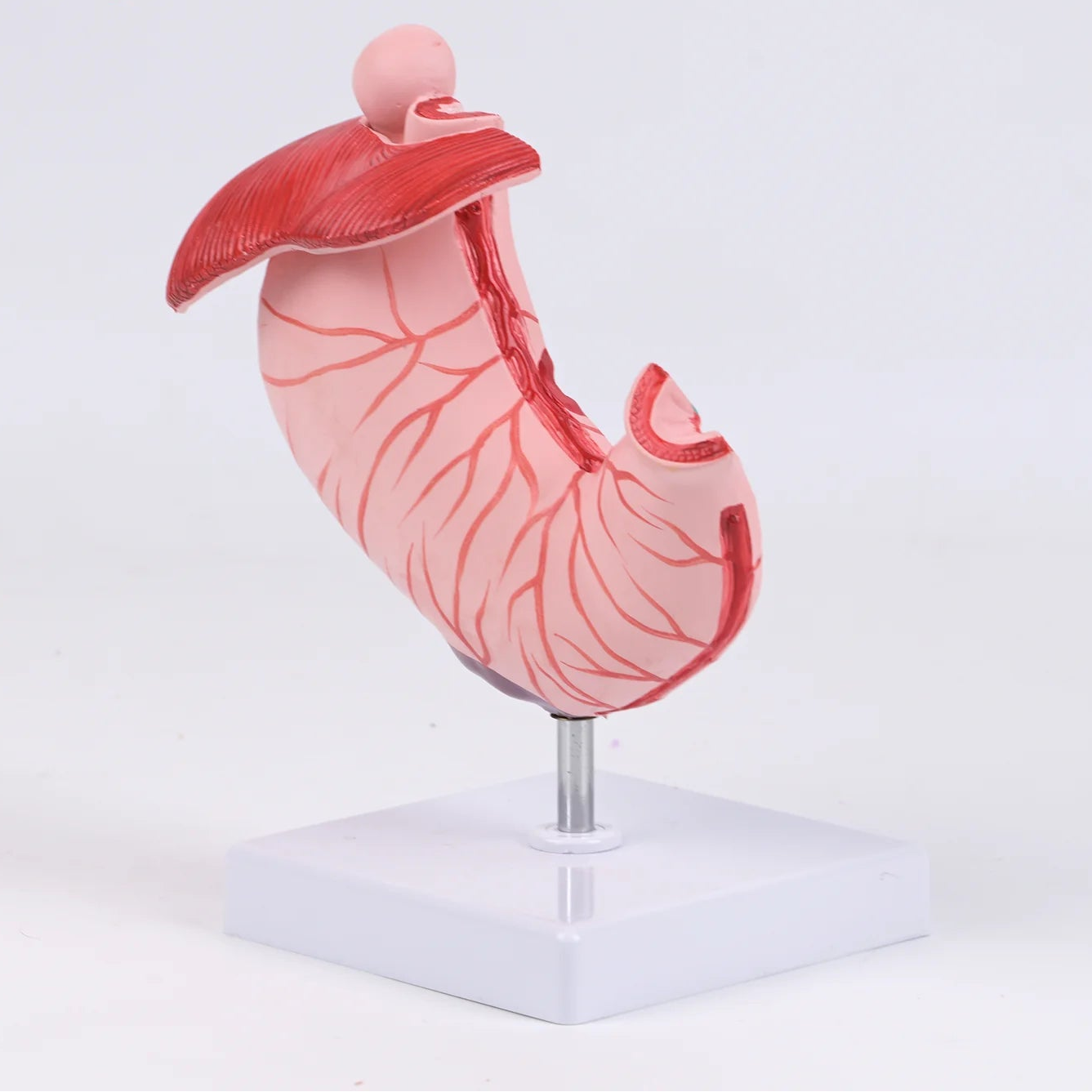 Pathological Stomach Anatomy Model