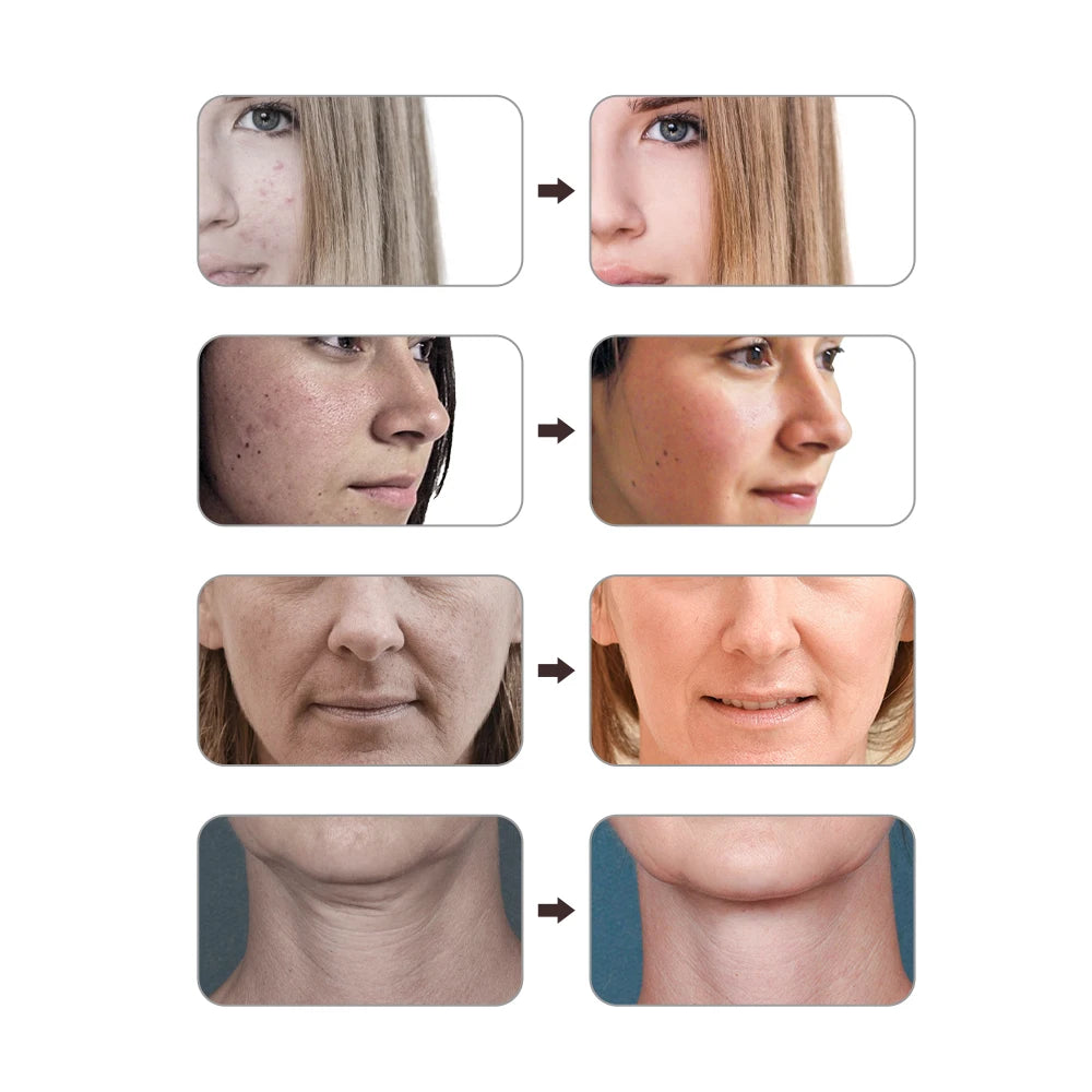 7 Colors Silicone Led Red Light Thearpy Face Mask 180 Lamp Beads Led Facial Mask For Anti Wrinkle Aging Tighten Rejuvenation